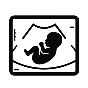 Simple minimal black silhouette of a fetus in womb on an ultrasound scan