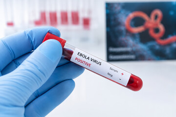 Obraz premium Ebola virus, positive blood test, laboratory, gloved hand, medical research, healthcare concept
