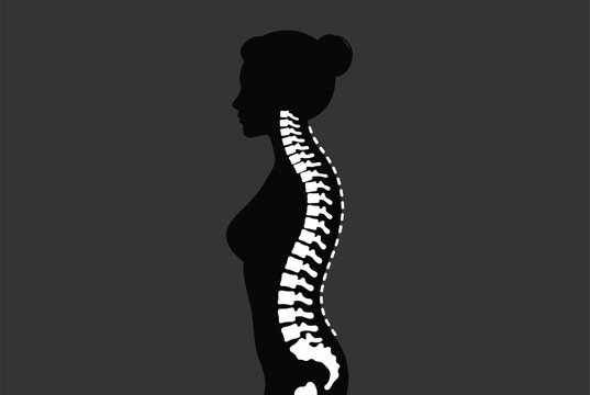 Female silhouette with a glowing white spine highlighted showing the anatomical structure of the vertebrae and spinal column.