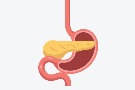Anatomical illustration showing the human stomach and pancreas connected to the duodenum in a simplified medical diagram.