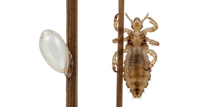 Head louse and nit on hair strand, macro photography, close-up detail