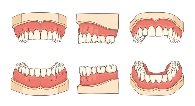 Detailed dental models showing various perspectives of human teeth and gums for orthodontic study and professional dentistry visualization.
