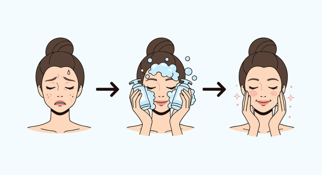 Step by step skincare routine showing a woman transforming her skin from acne and blemishes to a clear and glowing complexion.