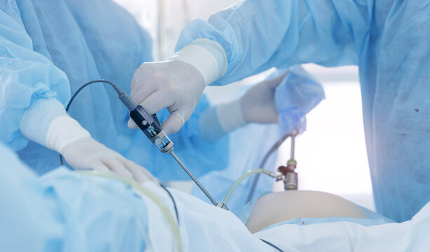 Surgical team performing laparoscopic procedure in operating room, medical background