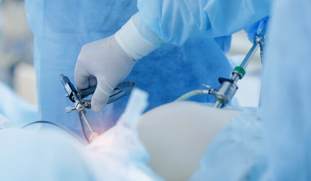 Surgical team operating with laparoscopic tools in operating room