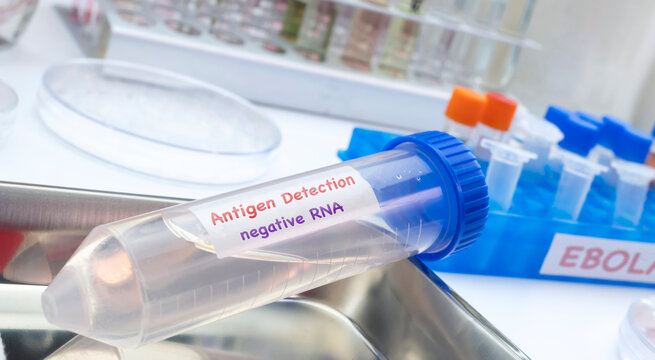 Several vials containing Ebola virus antigens for RNA detection, in a research laboratory; conceptual image