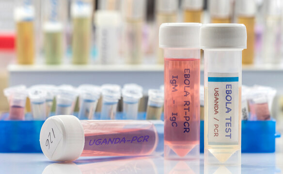 Several vials with Ebola virus from Uganda, IgM and IgC detection for research in a laboratory, conceptual image