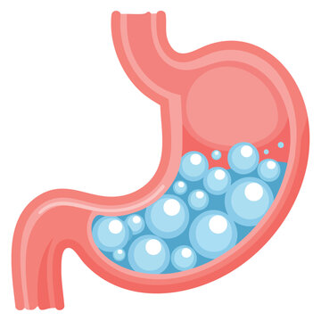 Digestive bloated stomach graphic icon in vector style. Suitable for healthcare themes, anatomy illustrations and medical awareness graphics.