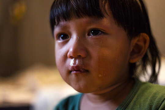Toddler Boy Crying With snot Bubble In His Nose