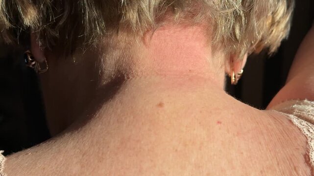 Closeup woman massaging neck with green roller, sunlit collar area with textured spike roller pressed against skin, gentle