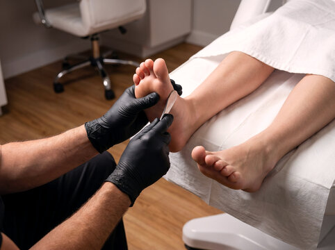 Podiatrist treating calluses on client's foot sole with metal scraper