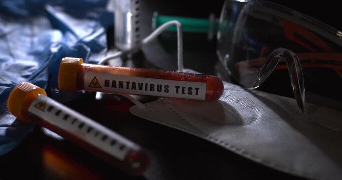 Super Slow Motion Close Examination Of Hantavirus Specimen On Mask In Highstakes Laboratory Environment