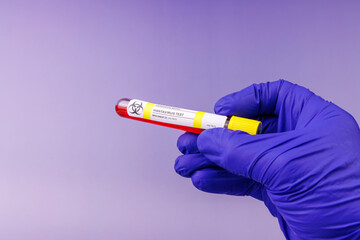 Obraz premium Gloved hand in blue holding a vibrant red hantavirus sample in a test tube on a violet gradient background for microbiology work.