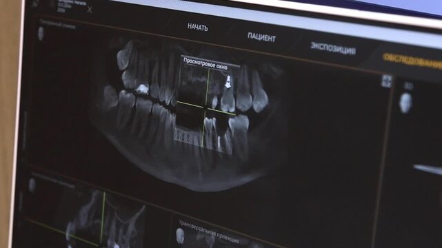 Detailed Dental Radiograph Display Showing Root And Surrounding Tissues For Treatment Planning