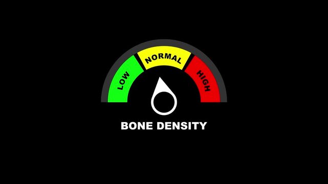 Animated bone density level meter moving from low to normal level, medical osteoporosis management concept on black background.