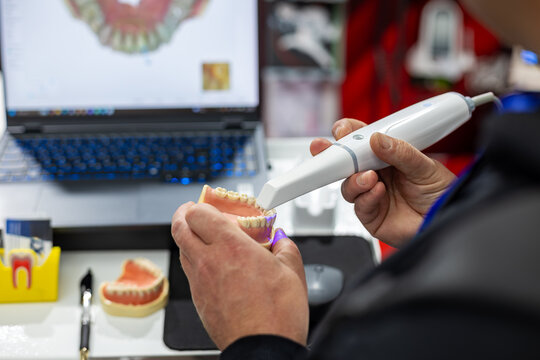 Dental Technician Scanning Tooth Model. Close-up of a dental technician using a digital scanner on a teeth model for modern dental design and treatment planning.