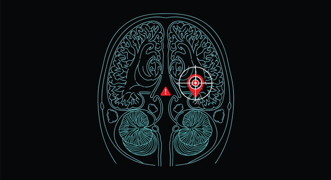 Medical neuroimaging graphic of a human brain featuring a red warning triangle and a specific target area for diagnostic identification.