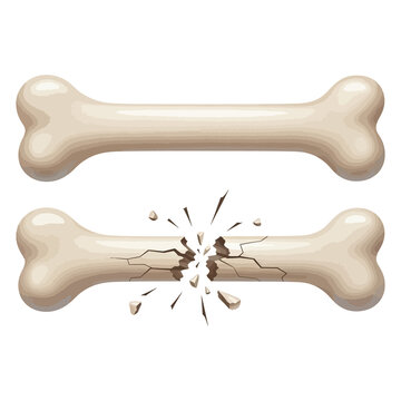 Two beige dog bones, one intact and one broken with cracks and fragments broken bone cracked bone