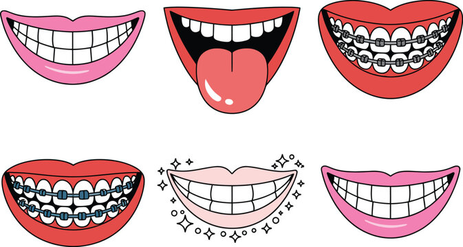 smiling mouth, teeth braces tongue and lips vector isolated playful dental background artwork