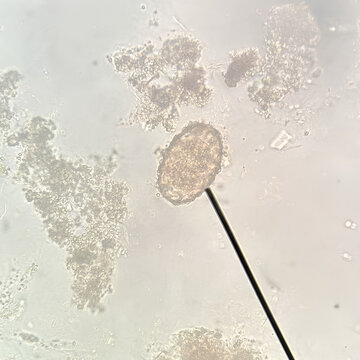 Schistosoma mekongi egg
