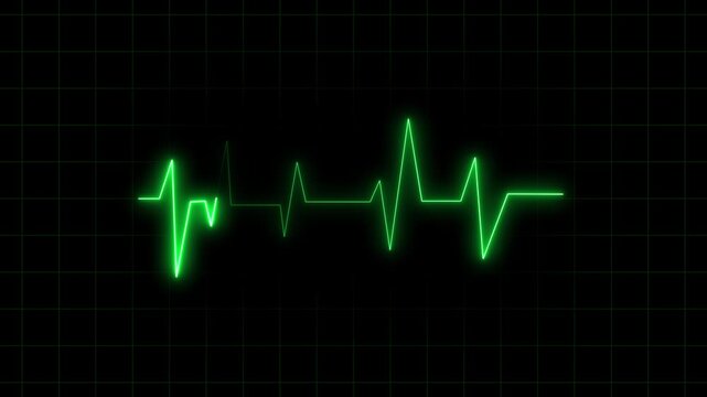 Neon green heartbeat line on dark grid background. Green heartbeat line for medical health monitor system. Digital green heartbeat animation for cardiology.