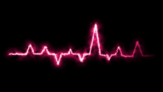 Heart beat line animation with glowing electrocardiogram waveform and sparkling red particles. Romantic valentines pulse concept mixed with futuristic medical monitor effect in cinematic ultra HD 4K b