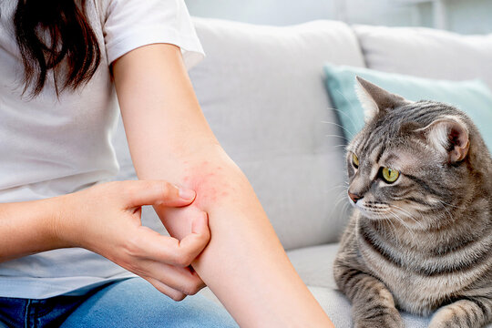 Woman checks skin rash on arm near pet cat at home. Allergic reaction or dermatitis caused by animal dander. Healthcare symptom, skin irritation and pet allergy concept on sofa.
