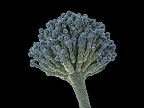Aspergillus Mold Fungus Under Electron Microscope on Black Background