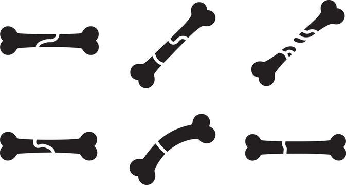 Broken bone icons set, fractured human bone vector silhouettes, medical injury and orthopedic trauma symbols, collection of 6 black bone fracture types for healthcare infographics, hospital signage, 