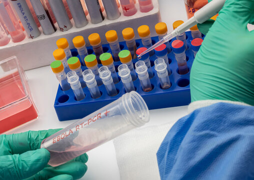 Several test tubes containing Ebola virus PCR samples in a research laboratory, conceptual image