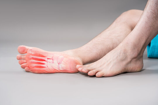 Joint diseases, hallux valgus, plantar fasciitis, heel spur, leg hurts, pain in the foot, male feet closeup
