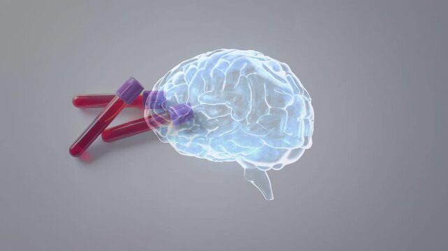 On playback glowing 3D brain rotating to overlap purple-capped tubes, highlighting temporal lobe