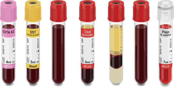 Medical Blood Test Tubes Vector Set with EDTA SST Clot Activator and Plain Vials for Laboratory Diagnostics Healthcare Infographics and Science Illustrations