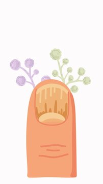 animation onychomycosis spreading across nail plate