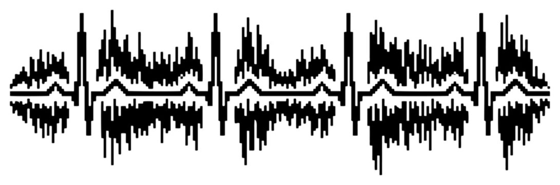 Heartbeat pulse monitor line with messy digital glitch sound wave distortion in medical tech style