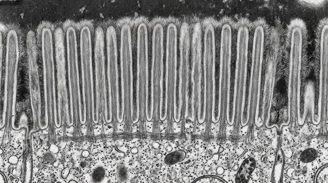 TEM longitudinal section of enterocyte apical surface with parallel microvilli