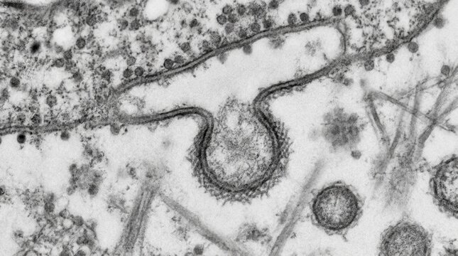 TEM of ER exit site showing COPII coated vesicle bud formation
