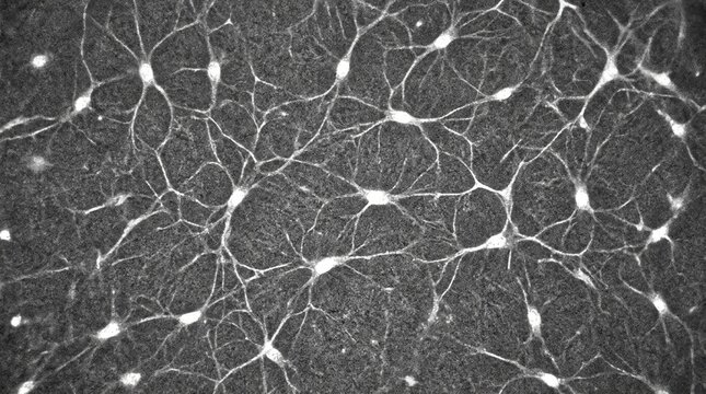 Confocal reflectance micrograph of corneal stroma interconnected keratocytes network