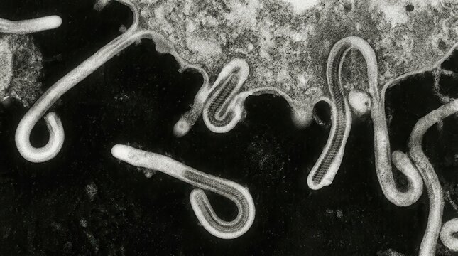 Ebola Virus Filamentous Particle Assembly, TEM Cell Margin