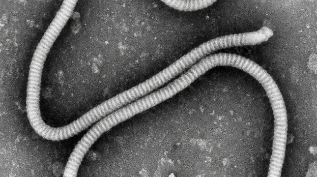 Marburg Virus Nucleocapsid Helical Structure, Negative Stain TEM