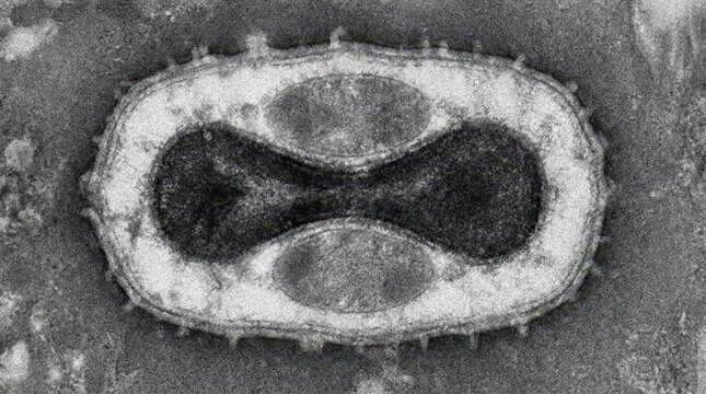 Monkeypox Virus Intracellular Mature Virion, TEM Cross-Section