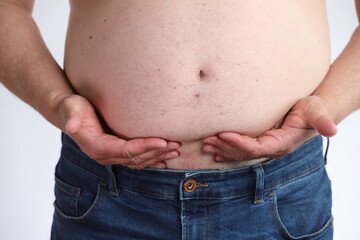 Naklejka premium Overweight man with belly in blue jeans. Concept of obesity, unhealthy lifestyle, excess weight and diet problems. Isolated on white background.