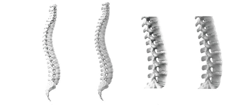 Close-up view of human vertebrae bone anatomy with vintage halftone dither effect