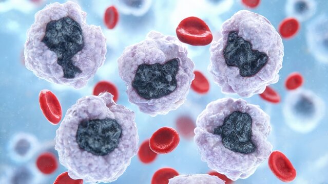 3D Microscopic View of Leukemia Cancer Cells and Normal Red Blood Cells in Bloodstream, Hematological Oncology Medical Illustration