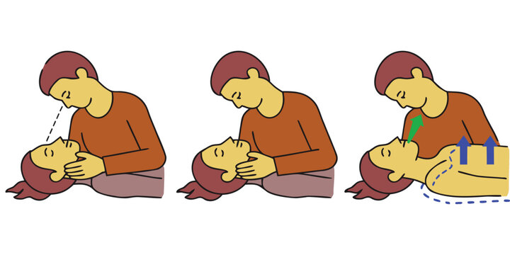 Emergency CPR Training Illustration with Rescue Breathing and Head Position Steps, First Aid Medical Procedure Concept, Life Saving Technique Vector.