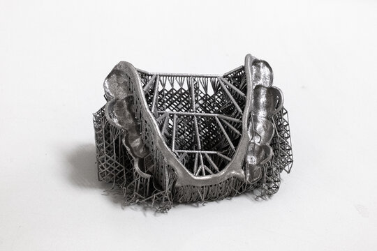 3D Printed Metal Partial Framework with Support Structure in Additive Manufacturing Process