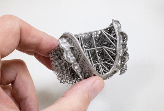 3D Printed Metal Partial Framework with Support Structure in Additive Manufacturing Process