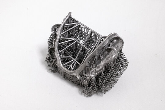 3D Printed Metal Partial Framework with Support Structure in Additive Manufacturing Process