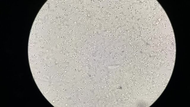 View of human sperm under the microscope