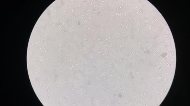 View of human sperm under the microscope